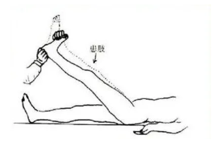 直腿抬高试验 直腿抬高试验