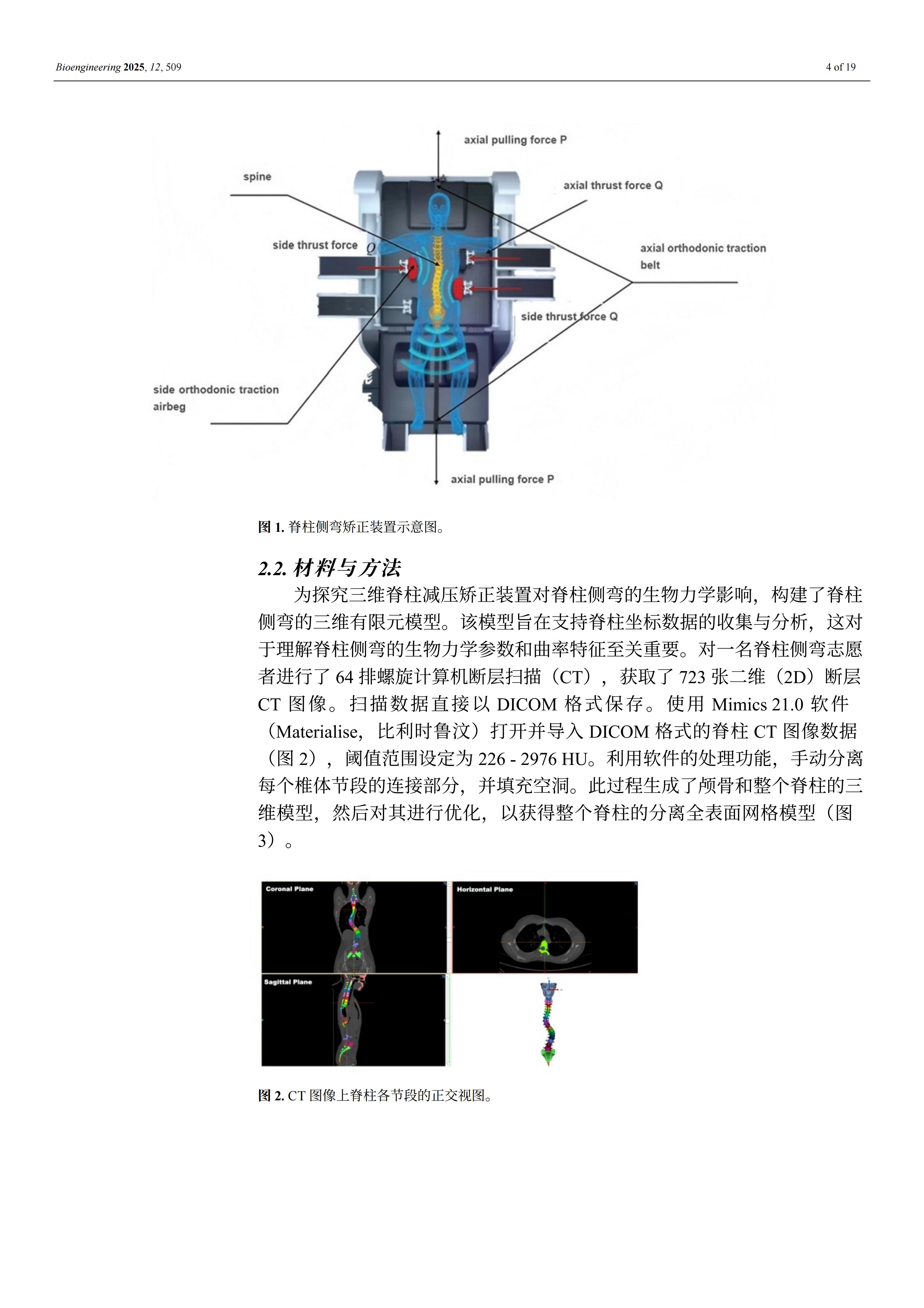 外星舱脊柱矫形装置的效果