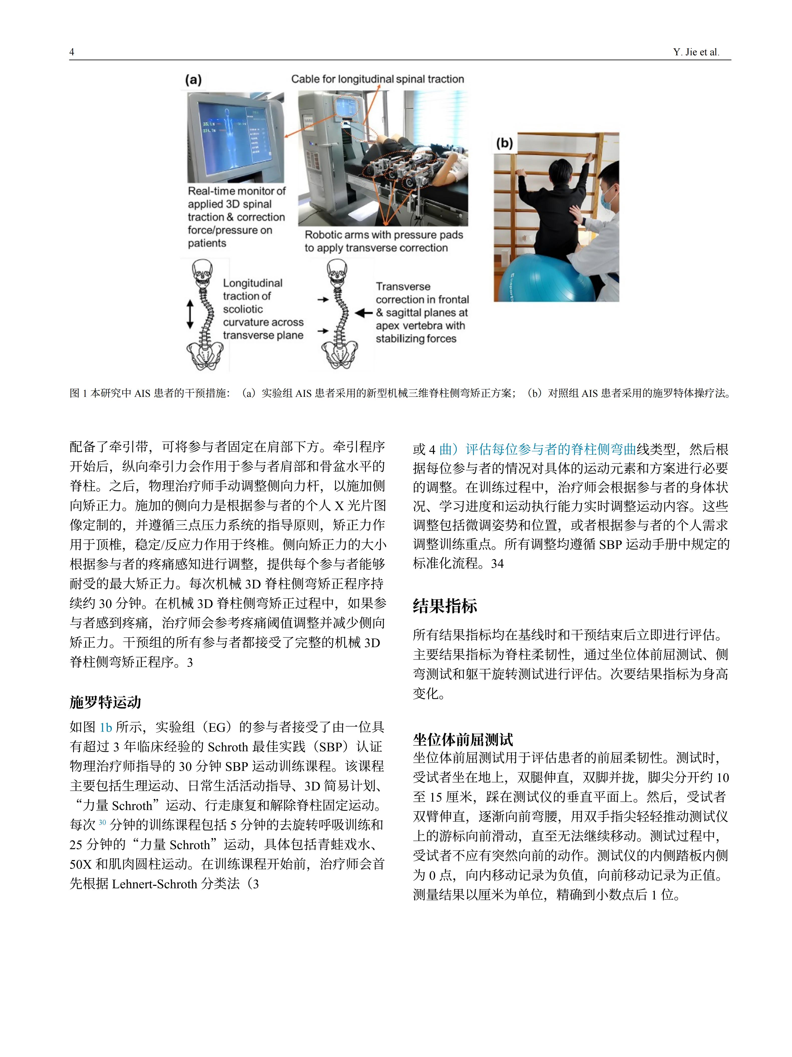 青少年特发性脊柱侧弯患者采用先进机械三维脊柱侧弯矫正方案临床效果